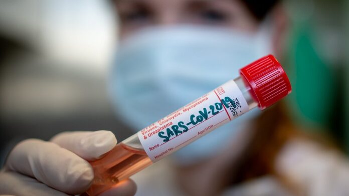 koronavirus-testy-odbery-laborator-2020