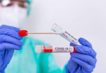 Plošné koronavirové testování v zařízeních CSP Litoměřice odhalilo 20 pozitivních