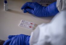 Začíná antigenní testování veřejnosti. Necháte se otestovat?