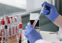 Potvrzení o negativním testu na koronavirus dostanete v Litoměřicích i v angličtině