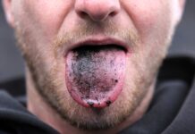 Do roudnické galerie míří uhlí